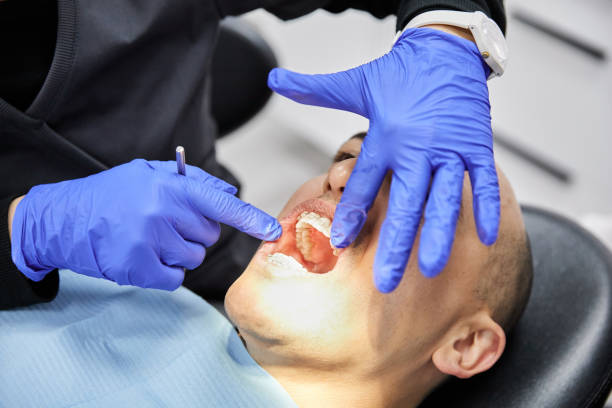 Best Emergency Broken Tooth Repair in Cordry Sweetwater Lakes, IN
